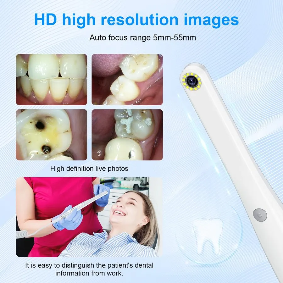 Pediatric Small-Head Intraoral Camera with Soft LED