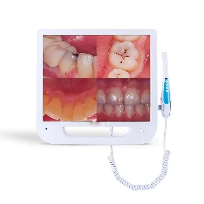 HD Intraoral Camera 1/4" CMOS with Docking Station